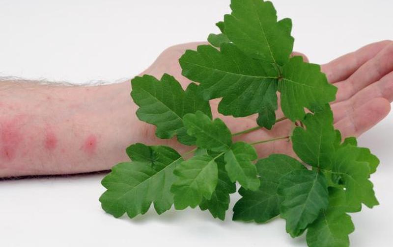 Ядовитый дуб с кожной сыпью