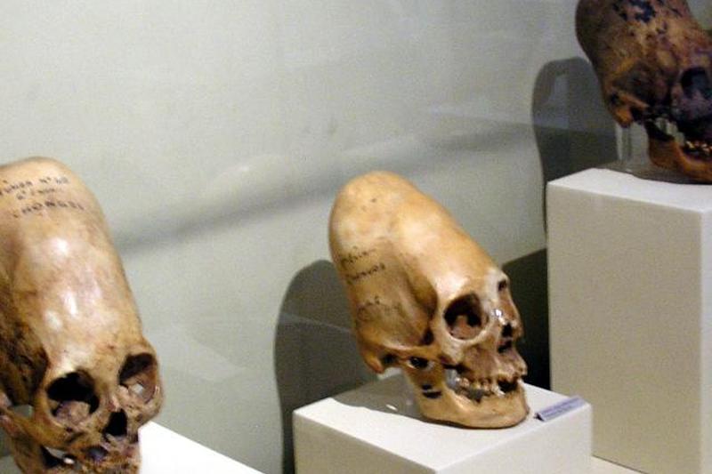 Черепа Паракаса в музее Ики