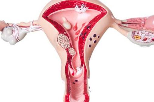 Матка и яичники