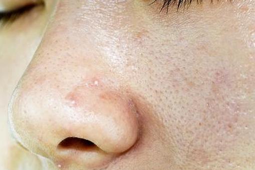 женское лицо с черными точками