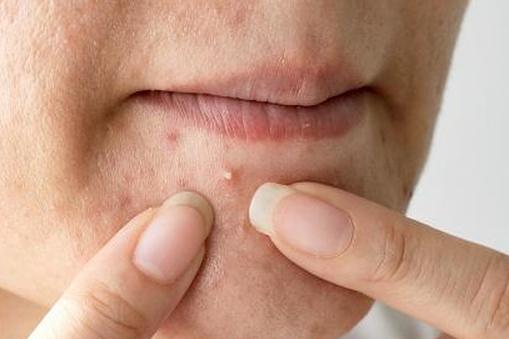 женское лицо с белыми точками