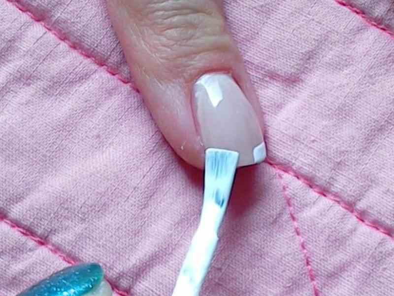 Противоположная сторона линии улыбки